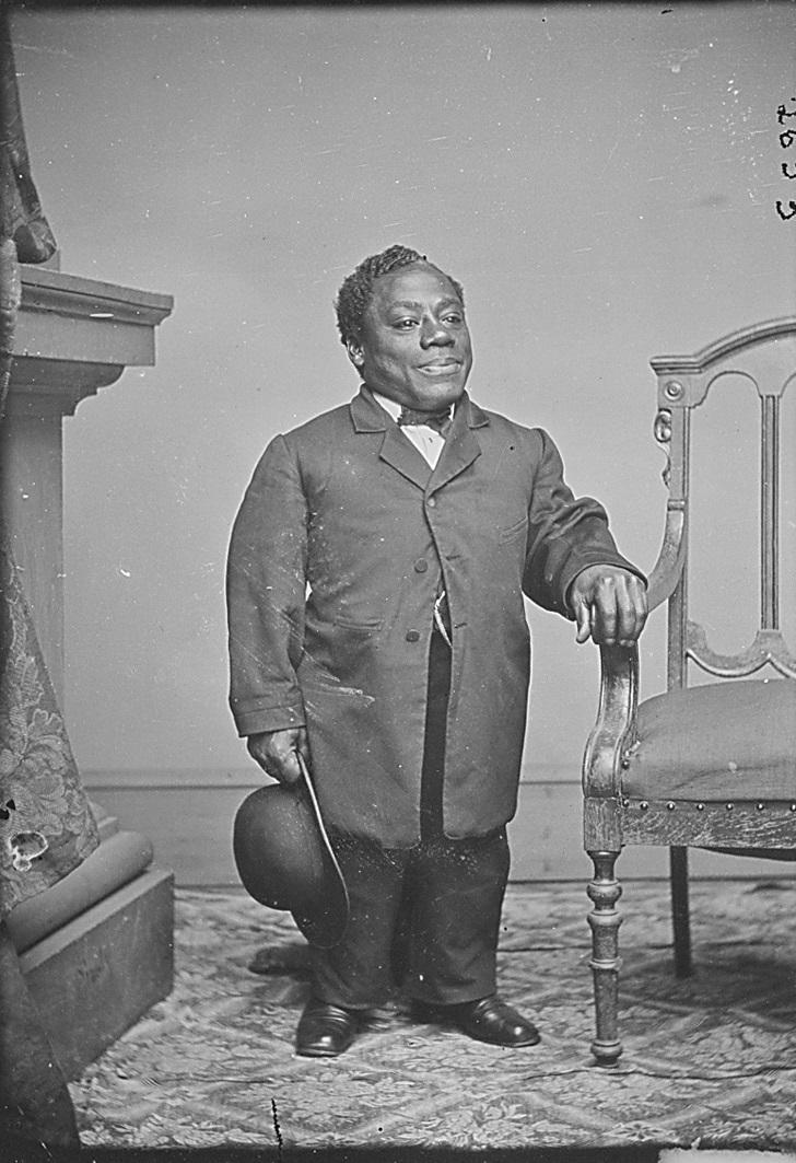 一位患有侏儒症的非裔美国人，约摄于1863年。