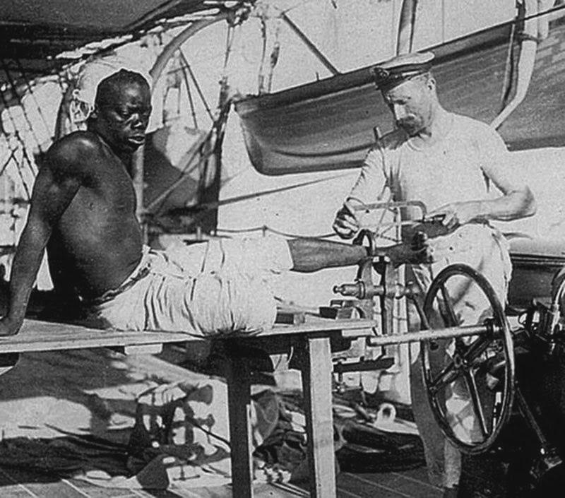 一位英国铁匠正在为一名奴隶卸除脚镣（1907年）