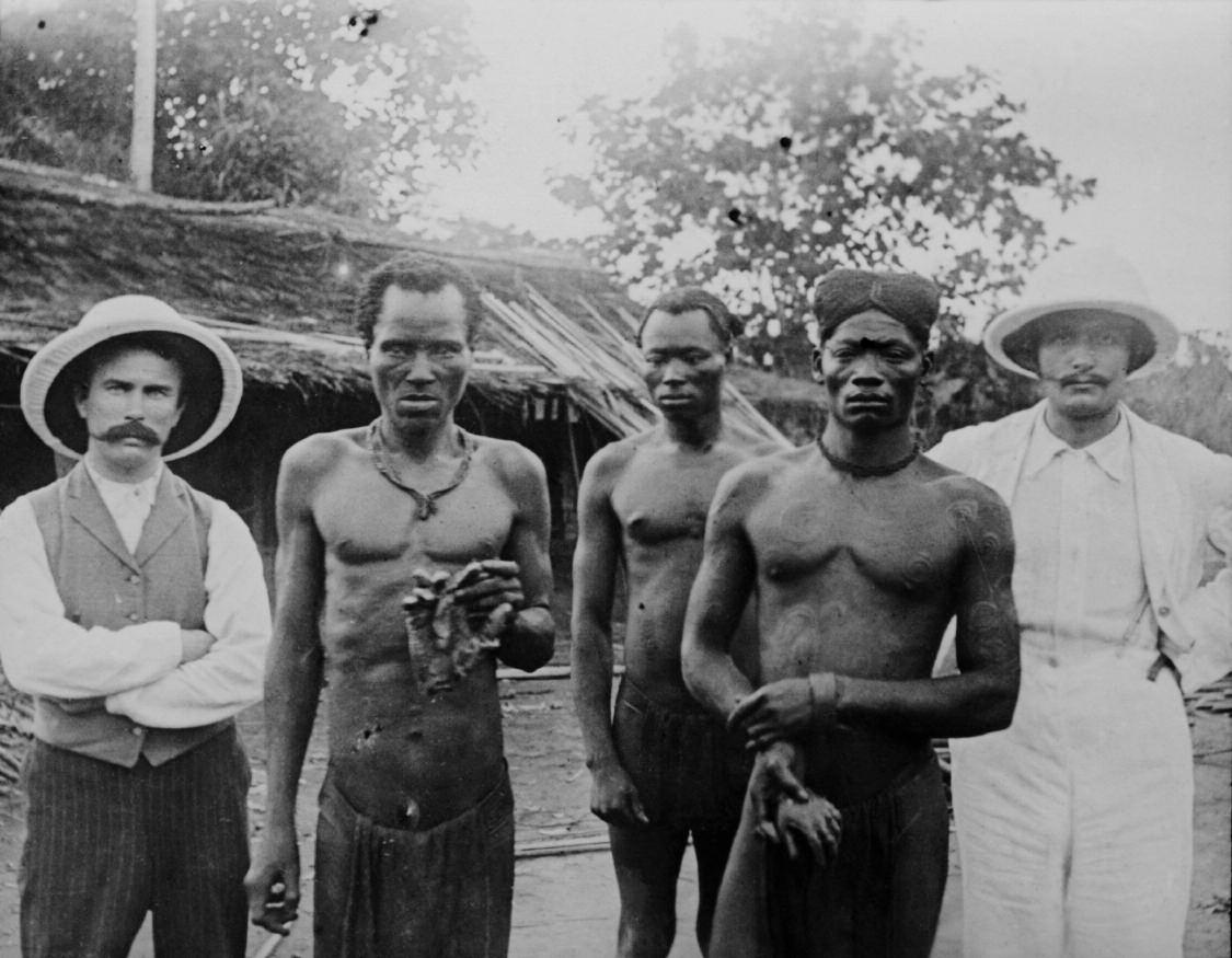 刚果自由邦男子手持砍下的手，1904年