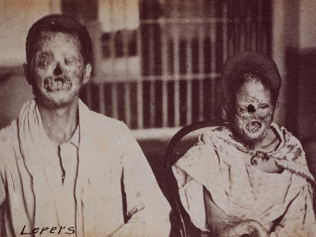 Leprosy patients, China, late 1800s [1024x768]